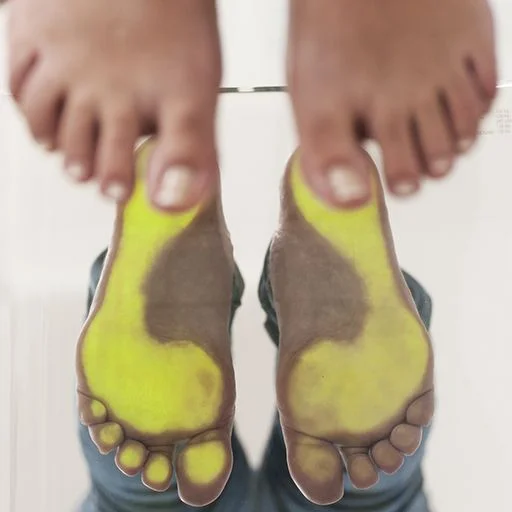 Dr.Robles4 Dr. Robles, traumatólogo especializado en pies