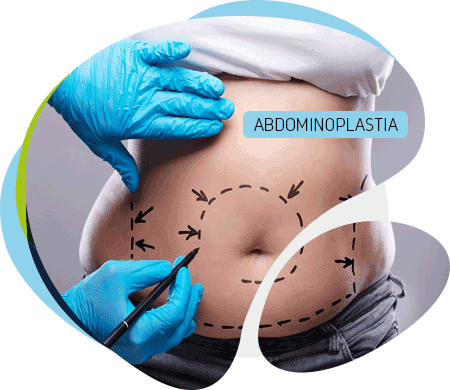 abdominoplastia-quito abdominoplastia-quito
