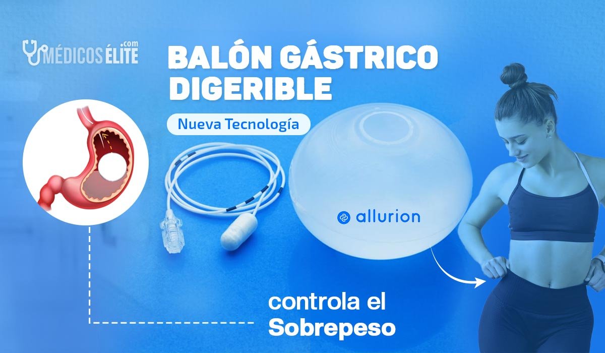 Balón Gástrico Digerible