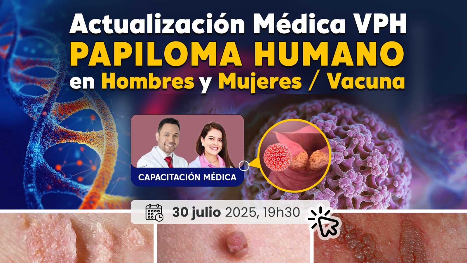 Capacitacion papiloma vph