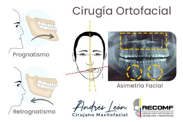 Cirugia ortofacial funcional estetica aeconmf