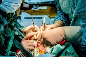 cirugia-vascular-quito