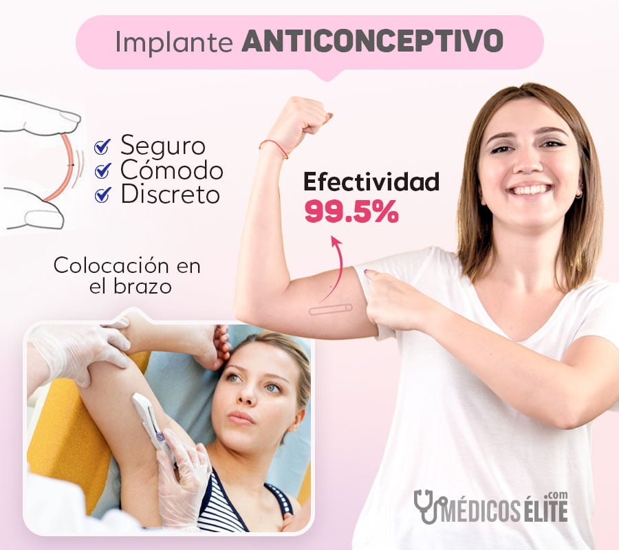 Colocación Implante Anticonceptivo