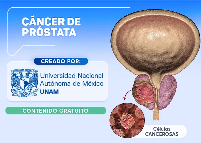 Curso Cáncer De Próstata
