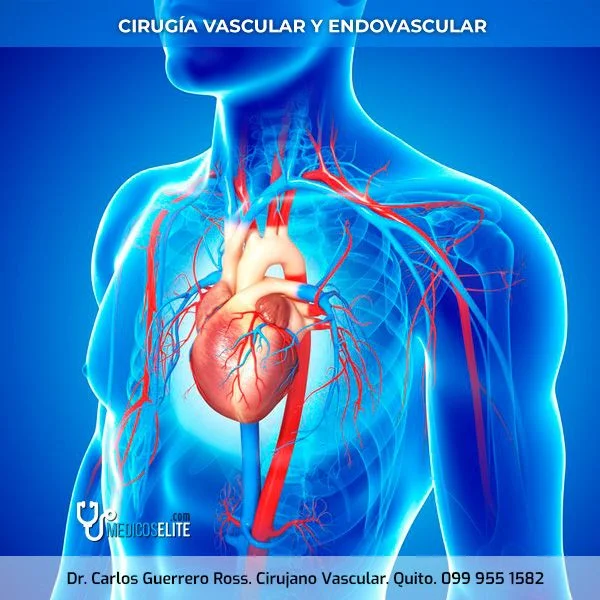 dr-carlos-guerrero-ross-cirujano-endovascular