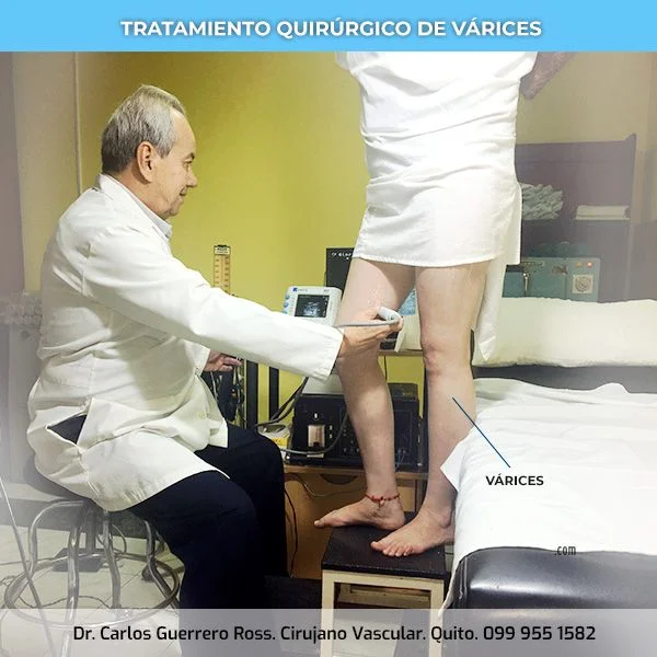 dr-carlos-guerrero-ross-examen-varices-quito