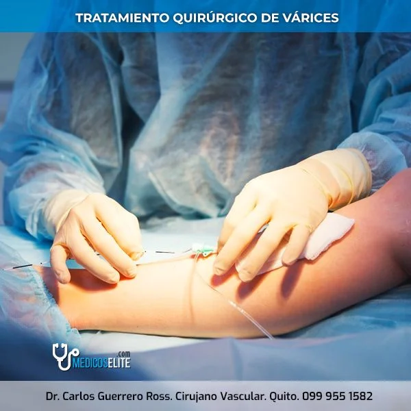 dr-carlos-guerrero-ross-tratamiento-quirurgico-varices