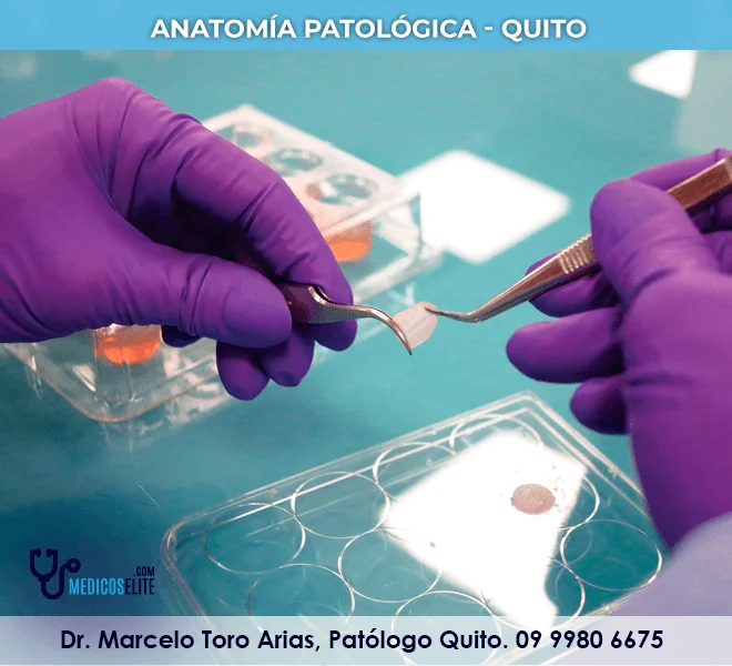 dr-marcelo-toro-arias- histopatologia-quito
