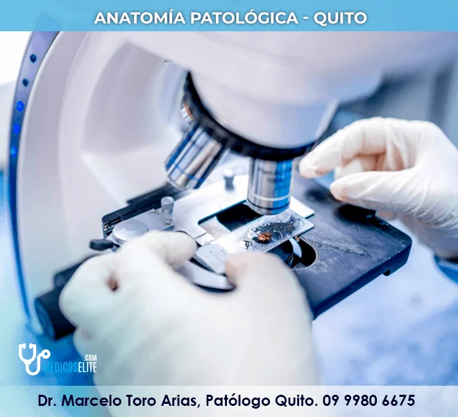 dr-marcelo-toro-arias-patologo-quito