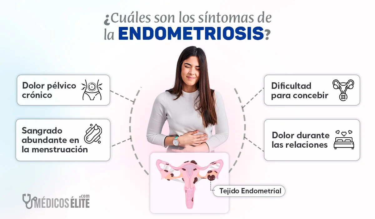 Síntomas de la Endometriosis Síntomas de la Endometriosis