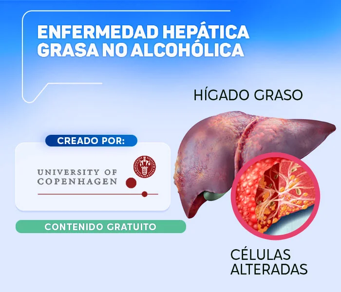 Enfermedad hepatica grasa no alcoholica