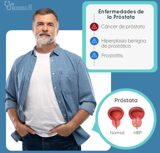 Cáncer de próstata, hiperplasia y prostatitis