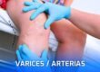 especialista-en-varices