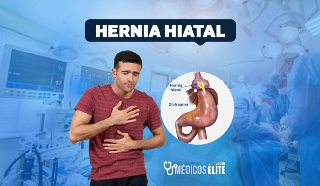 Hernia Hiatal Cirugía