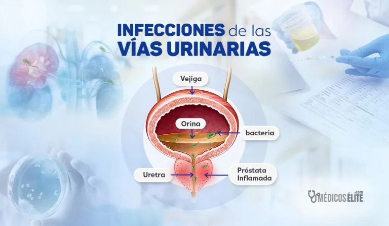 Infecciones de las Vías Urinarias Infecciones de las Vías Urinarias