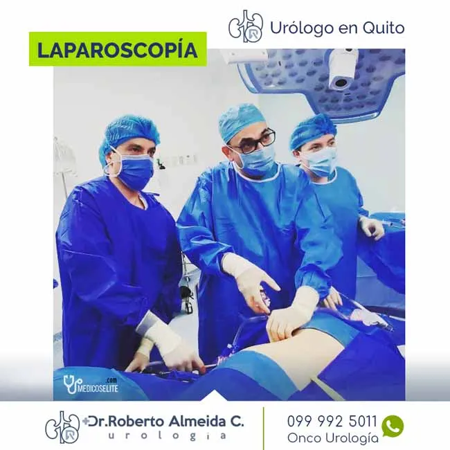 laparoscopia-urologica laparoscopia-urologica