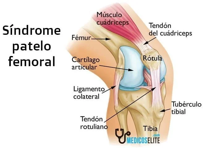 Lesiones deporte rodilla