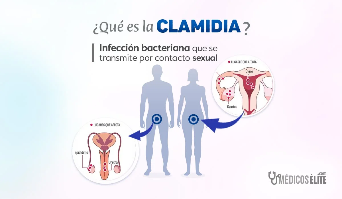 ¿qué Es La Clamidia? qué Es La Clamidia