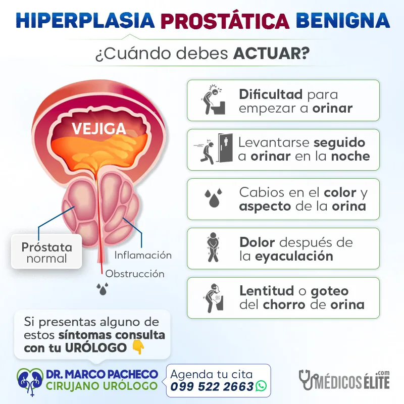 Síntomas de la Hiperplasia Prostática Benigna HPB