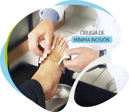 traumatologo-de-pies-quito traumatologo-de-pies-quito