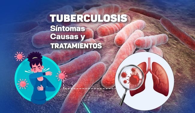 Tuberculosis, síntomas, causas y tratamientos