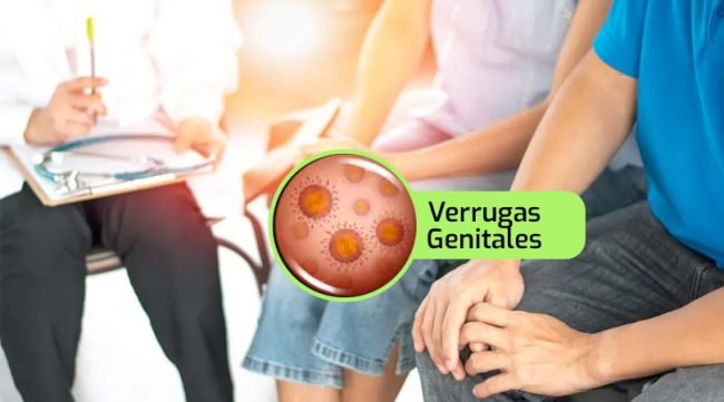 Verrugas producidas por el Virus del Papiloma Humano VPH en hombres
